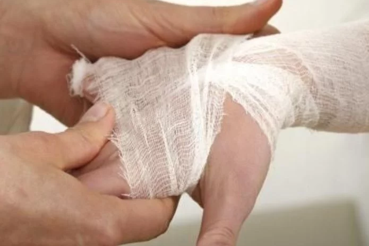 Detección y atención oportuna de la Lepra 1 Lepra