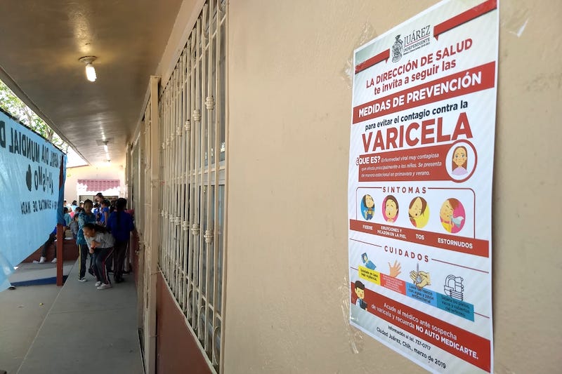 Varicela prevencion