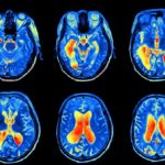 Contrata Pensiones Civiles servicio subrogado de medicina nuclear 1 medicina nuclear1