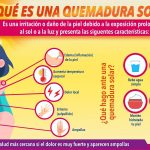 Emite Secretaría de Salud recomendaciones ante padecimientos en temporada de calor 2 calor 2