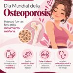 Exhorta Salud Municipal a prevenir la osteoporosis y reducir riesgos de fracturas en Ciudad Juárez 1 6ad7b9ea007a6 6ad7b9ea007a7